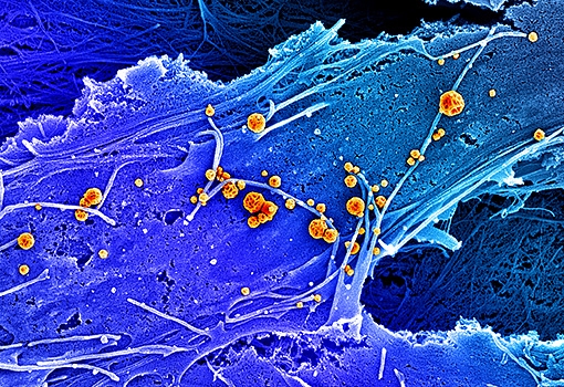 False-colored scanning electron microscopy image of human fibroblasts secreting (orange) matrix-bound nanovesicles. Illustration courtesy of Marley Dewey.